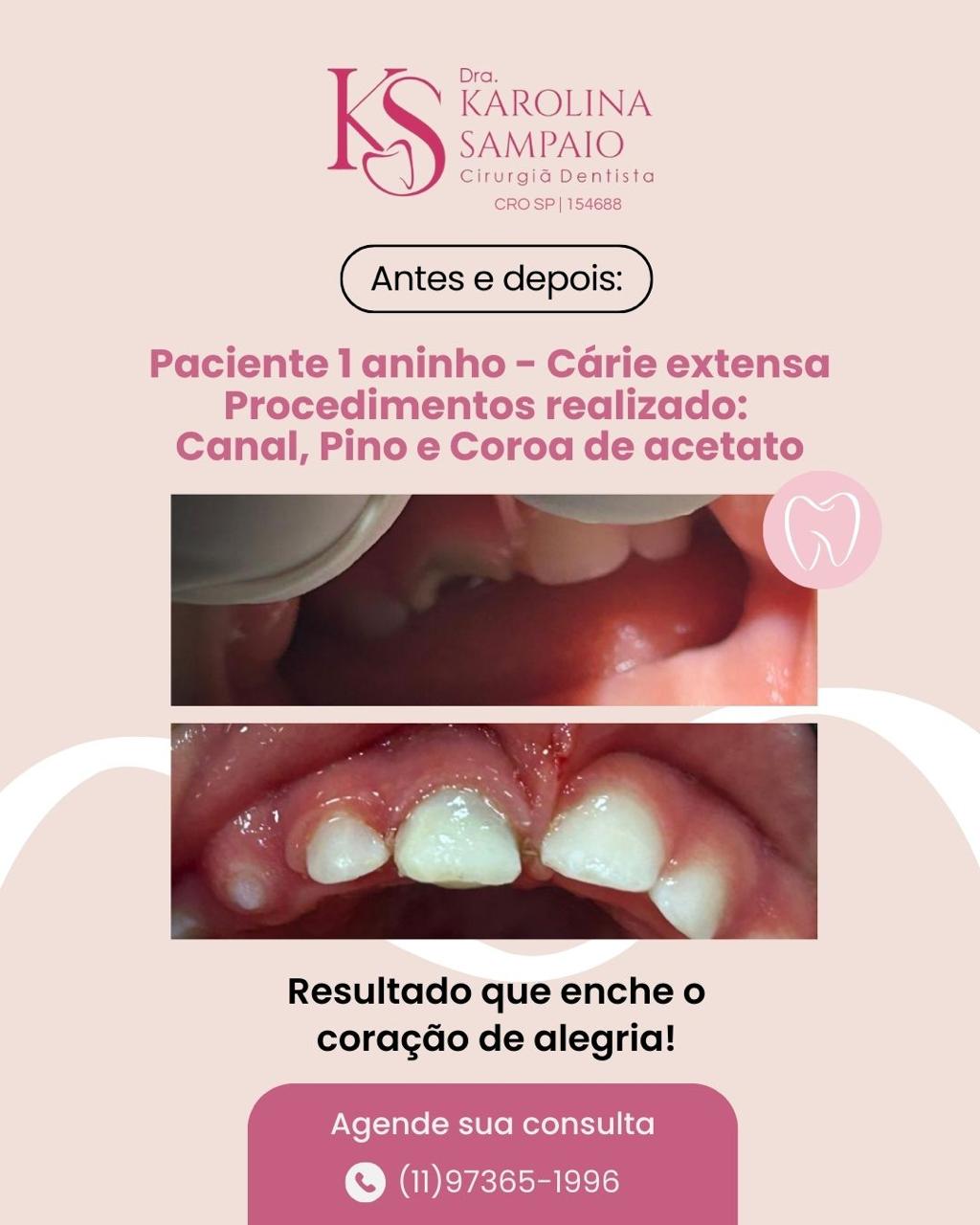 Resultado 6